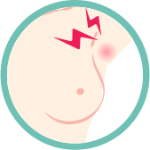 乳腺癌