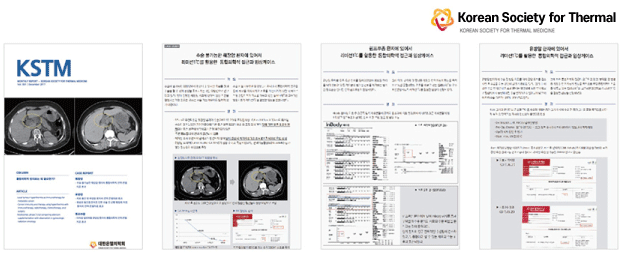 高频温热癌症治疗