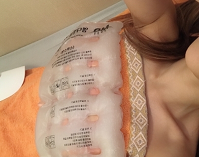 MD 手术案例