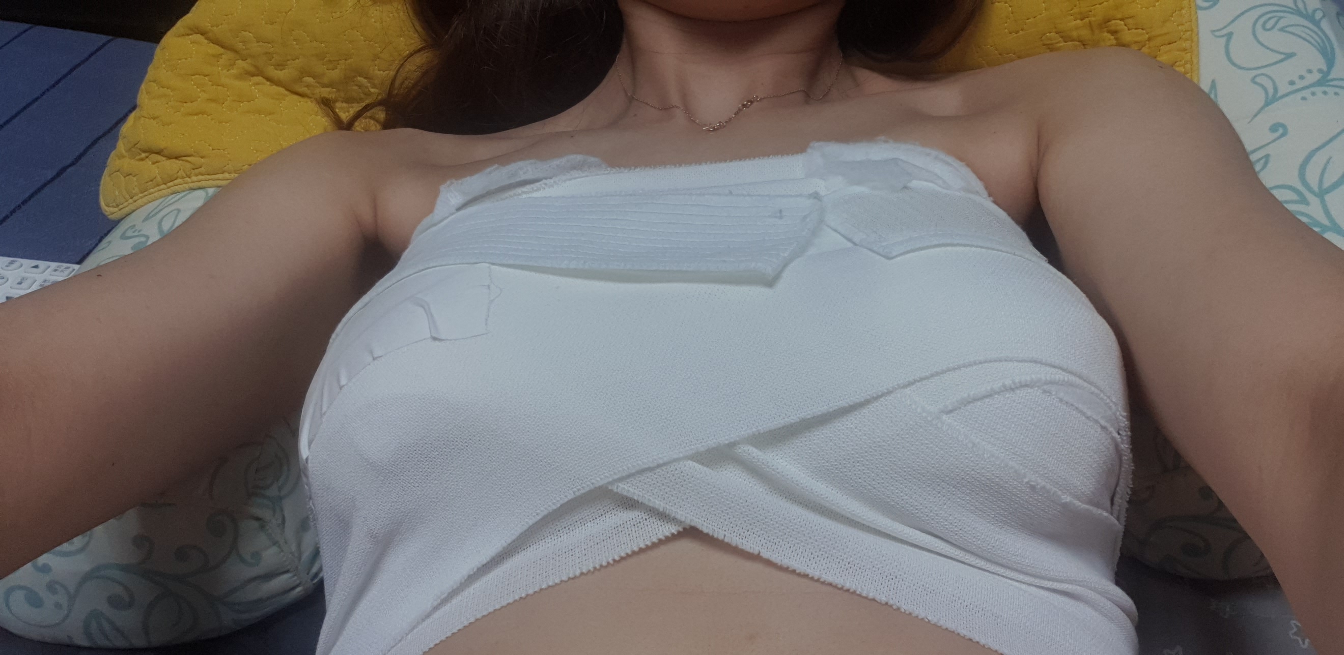 MD 手术案例