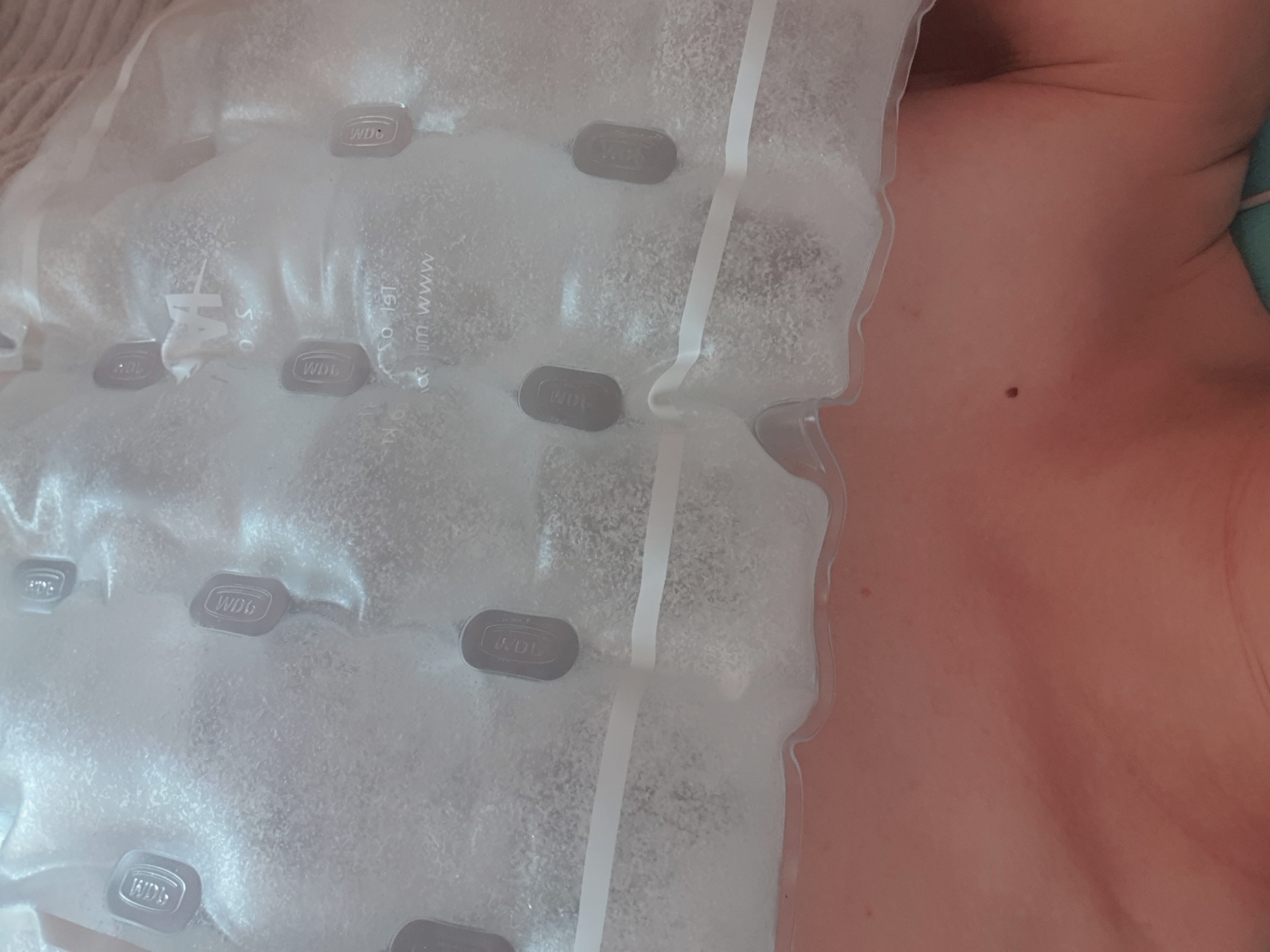 MD 手术案例