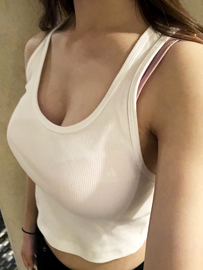 MD 手术案例