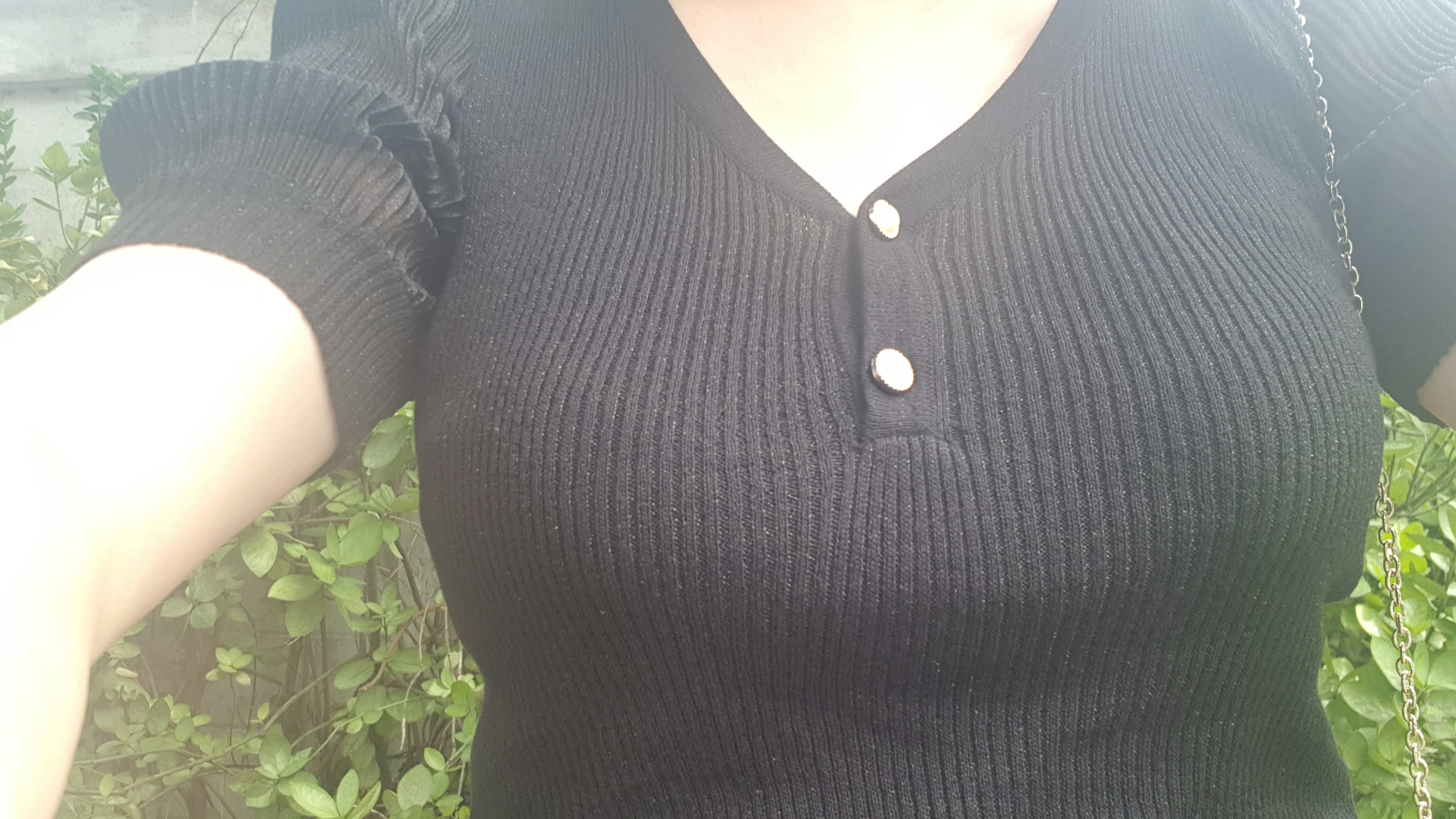 MD 手术案例