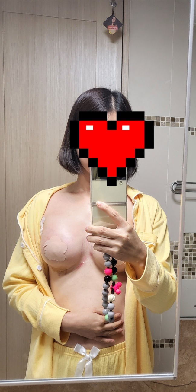 MD 手术案例