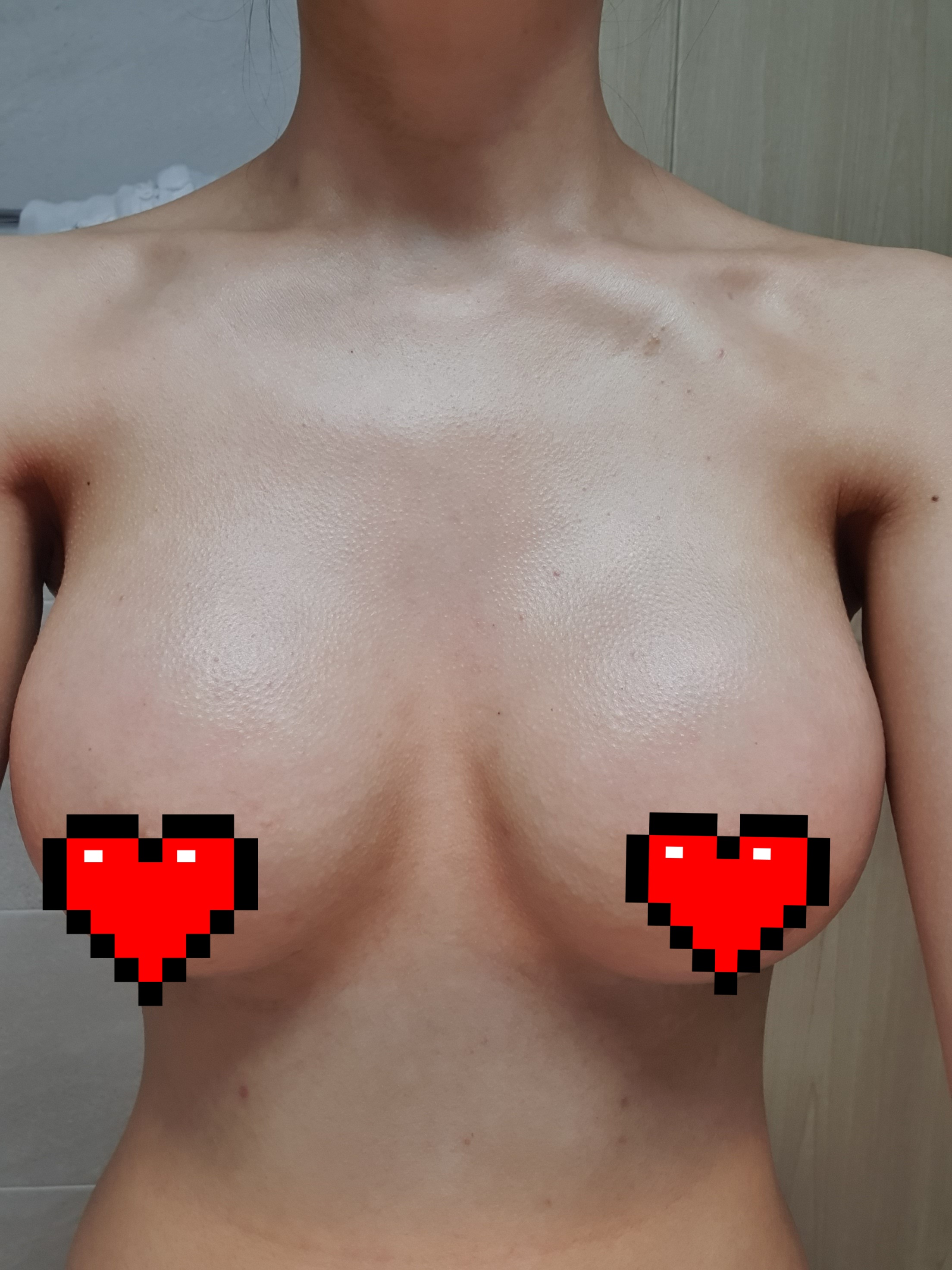 MD 手术案例