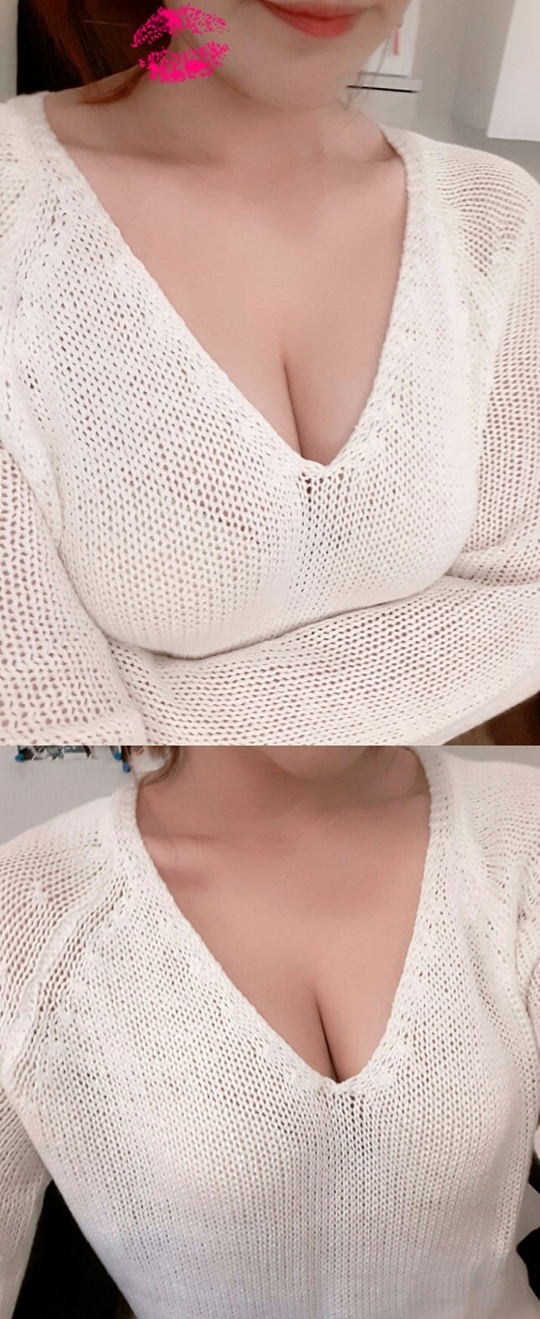 MD 手术案例
