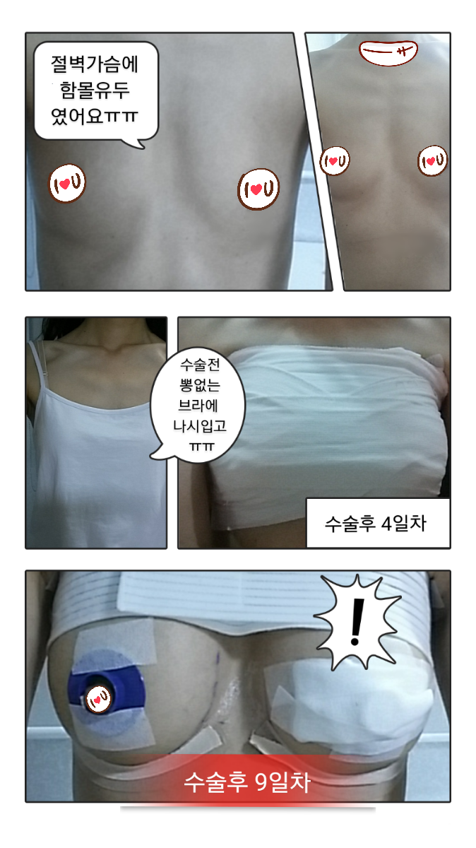 MD 手术案例