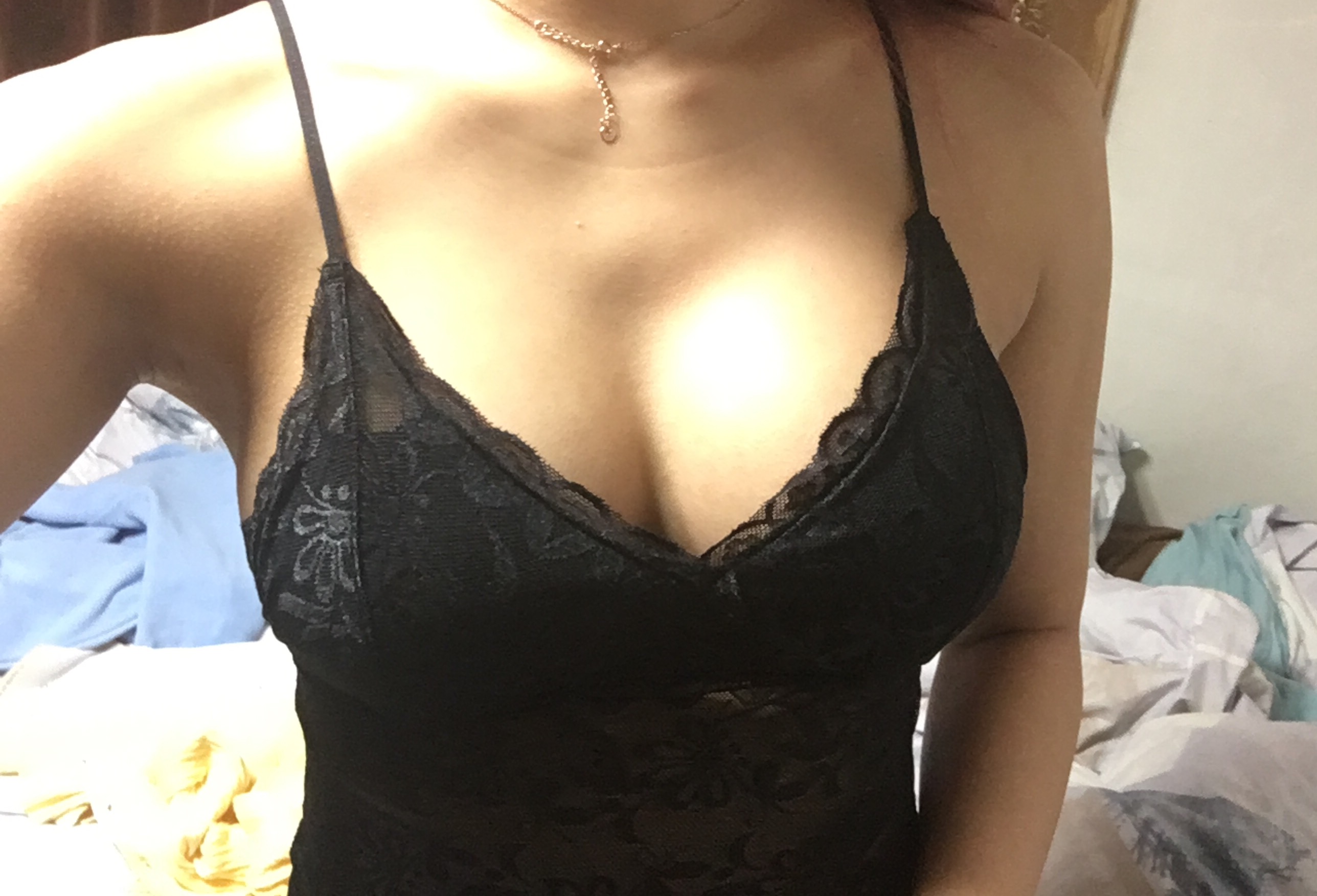 MD 手术案例