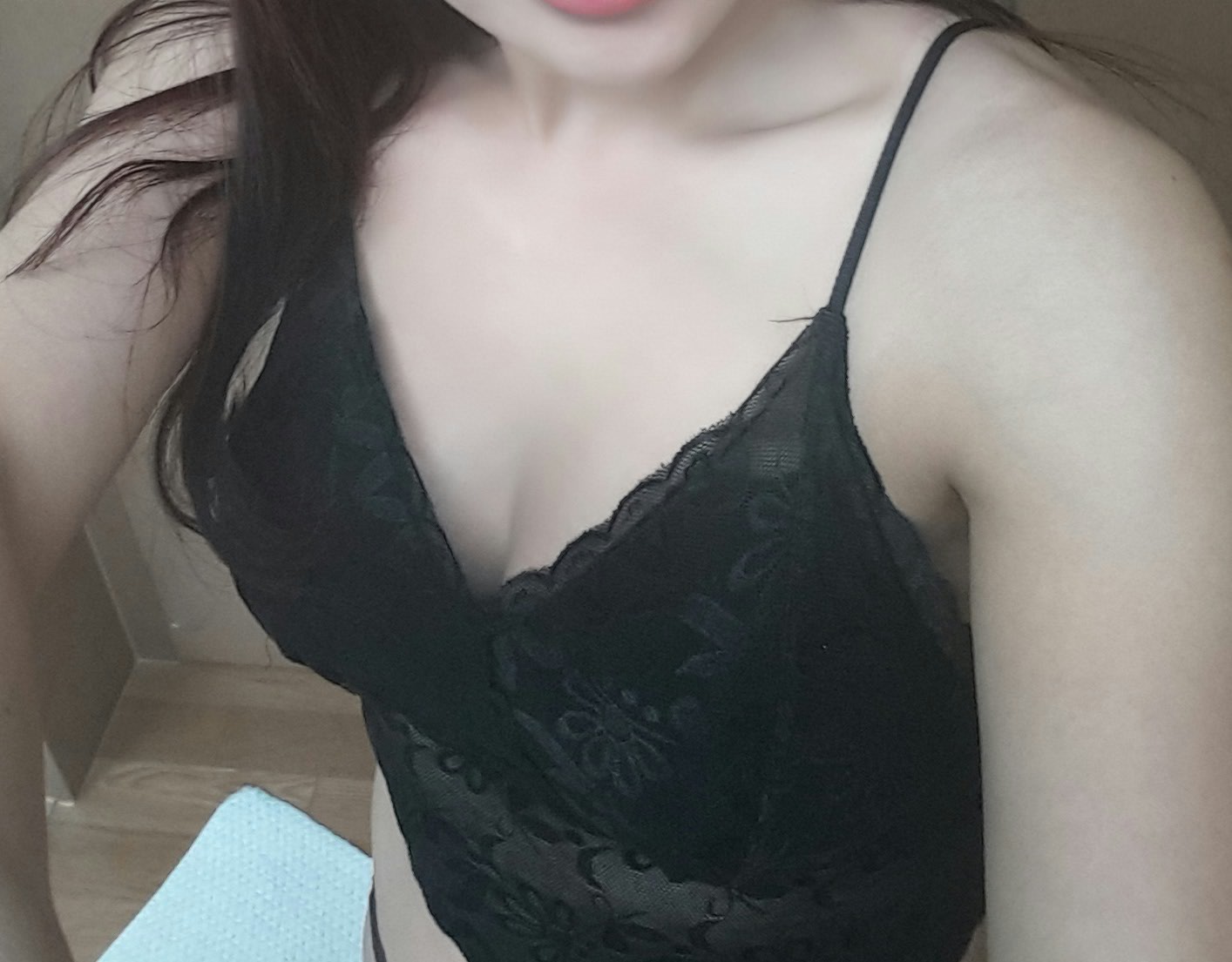 MD 手术案例