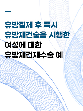 MD外科 胸部整形